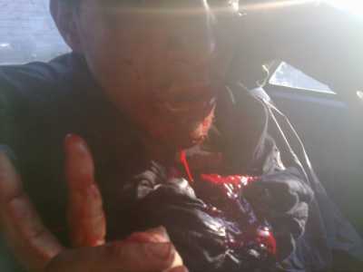 La imagen es de un saharaui agredido por la policia marroqu | SaharaThawra